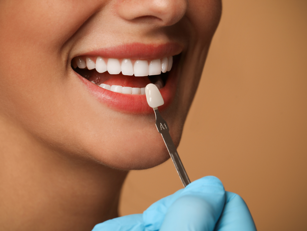 Patient smiling confidently after a full smile makeover in Louisville, KY