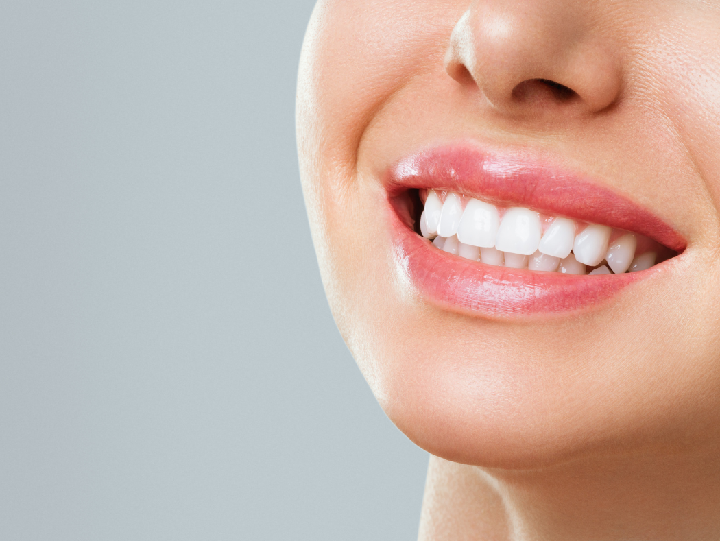 Close-up of a whitened smile showing professional teeth whitening results in Louisville, KY