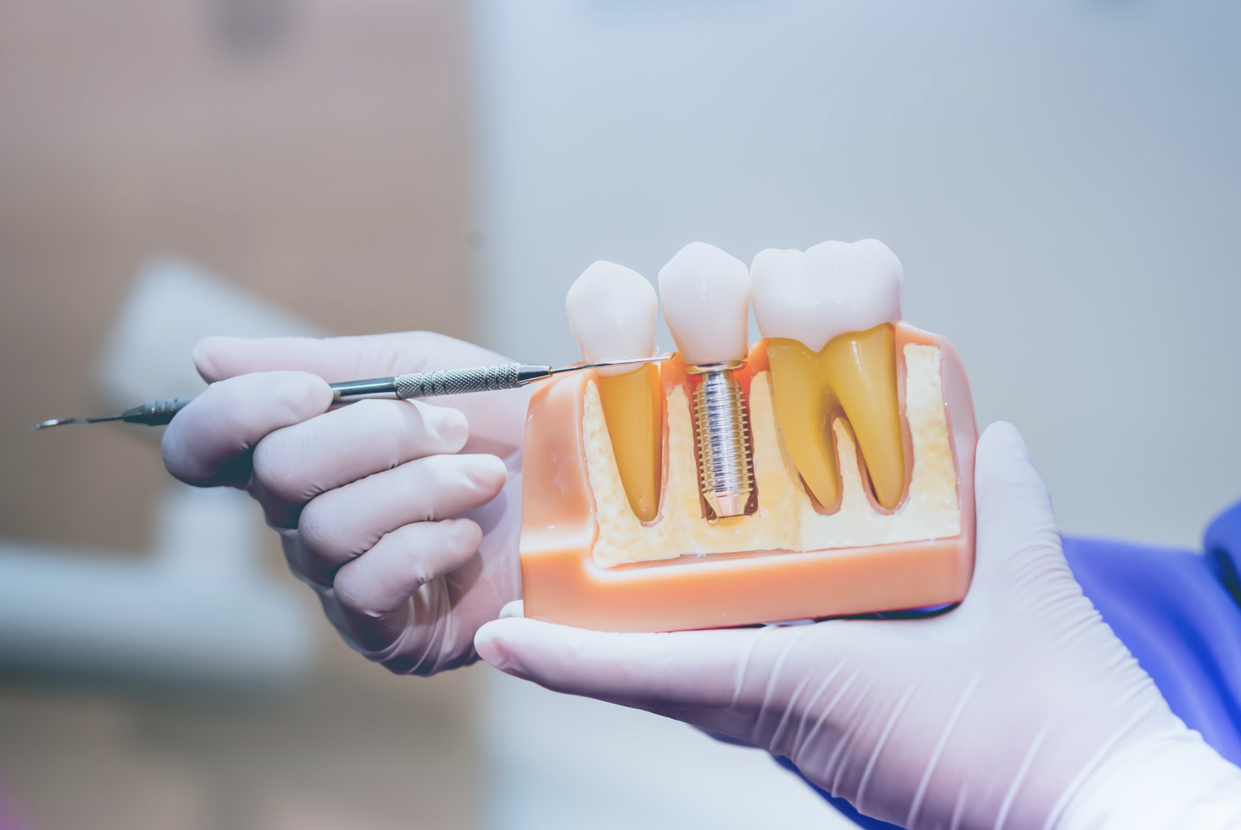 Close-up of a dental implant model used to explain tooth replacement options in Louisville, KY