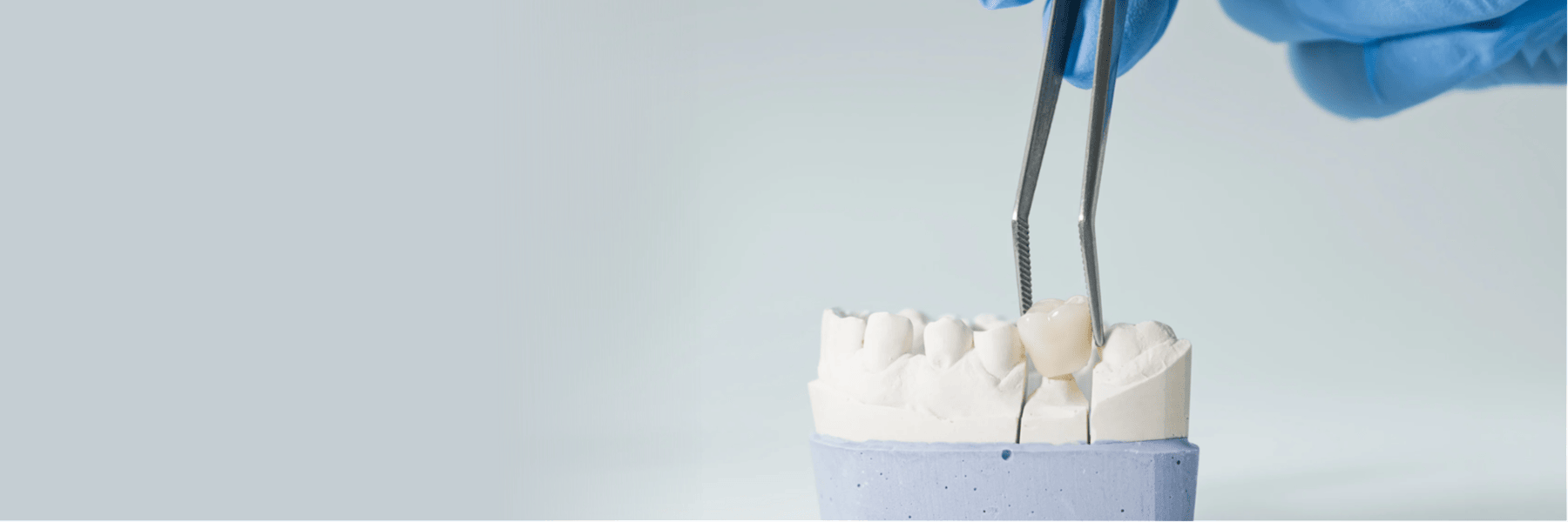 A dental crown in Louisville, KY