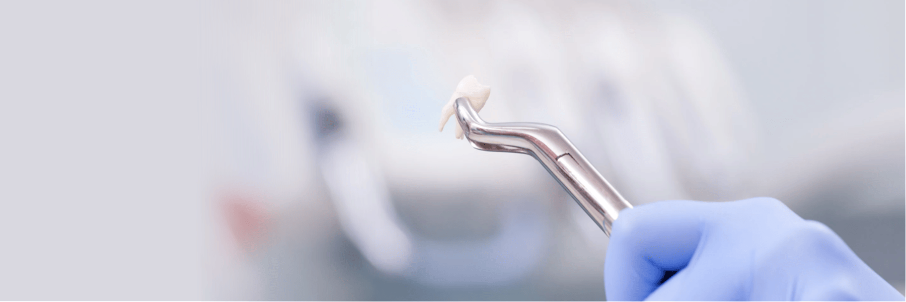 A dentist holding a tooth after a tooth extractions in Louisville, KY.