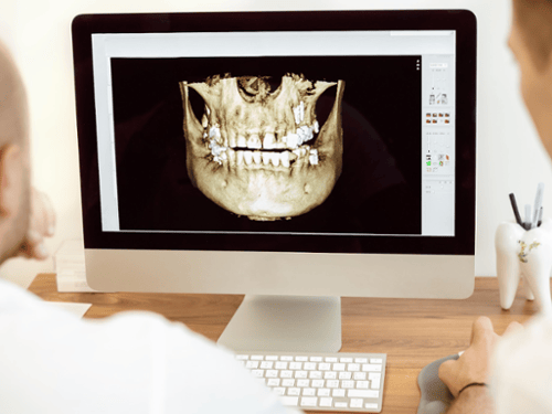 CBCT Cone Beam Technology