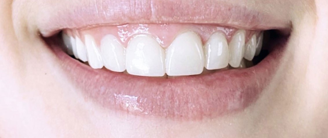 Robinson Family Dental