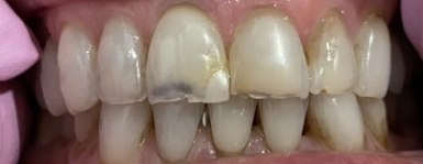Robinson Family Dental